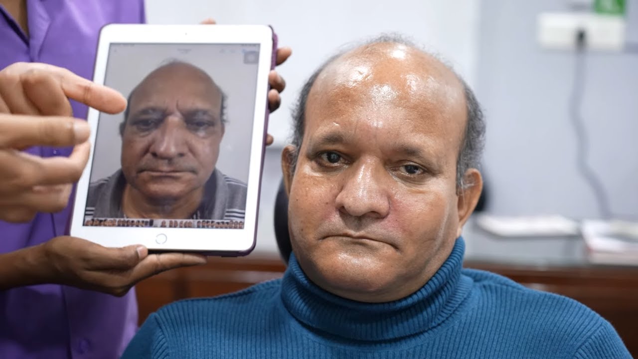 60 year Old Grandpa Does Plastic Surgery