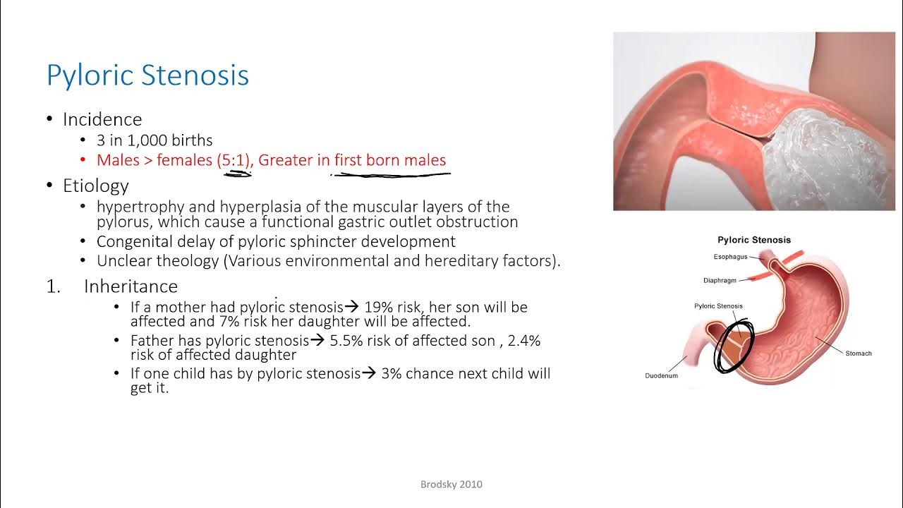 Causes Of Persistent Vomiting In Infant