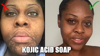 WHY KOJIC ACID SOAP ISN'T WORKING FOR YOU (What no-one is telling you)