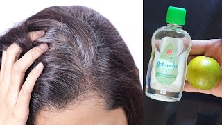White hair will disappear forever in just 5 minutes! 💯 tested and effective