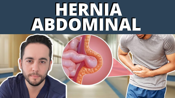 ABDOMINAL WALL HERNIA - INGUINAL AND UMBILICAL HERNIAS 💥 Causes, Symptoms, treatment, complications