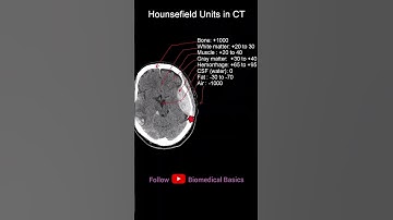 CT Hounsefield  #shorts #biomedicalengineering #radiology