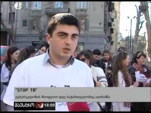 გიგა სორდია  (stop TB)