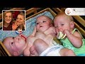 Conjoined Garrison Triplets: Rarest Triplets Before and After Separation! ~ Body Bizarre!