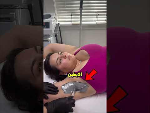 الحل النهائي لرائحة الإبطين