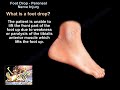 Foot Drop Peroneal Nerve Injury - Everything You Need To Know - Dr. Nabil Ebraheim