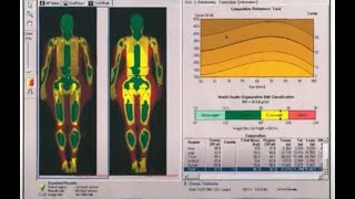 DEXA Scan Body Composition is the gold standard! Why settle for less than the best?