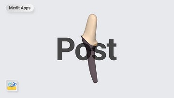 Designing a Post with Medit Apps