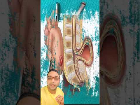 ولادة طفل بذيل فى البرازيل حالة نادرة جدا 