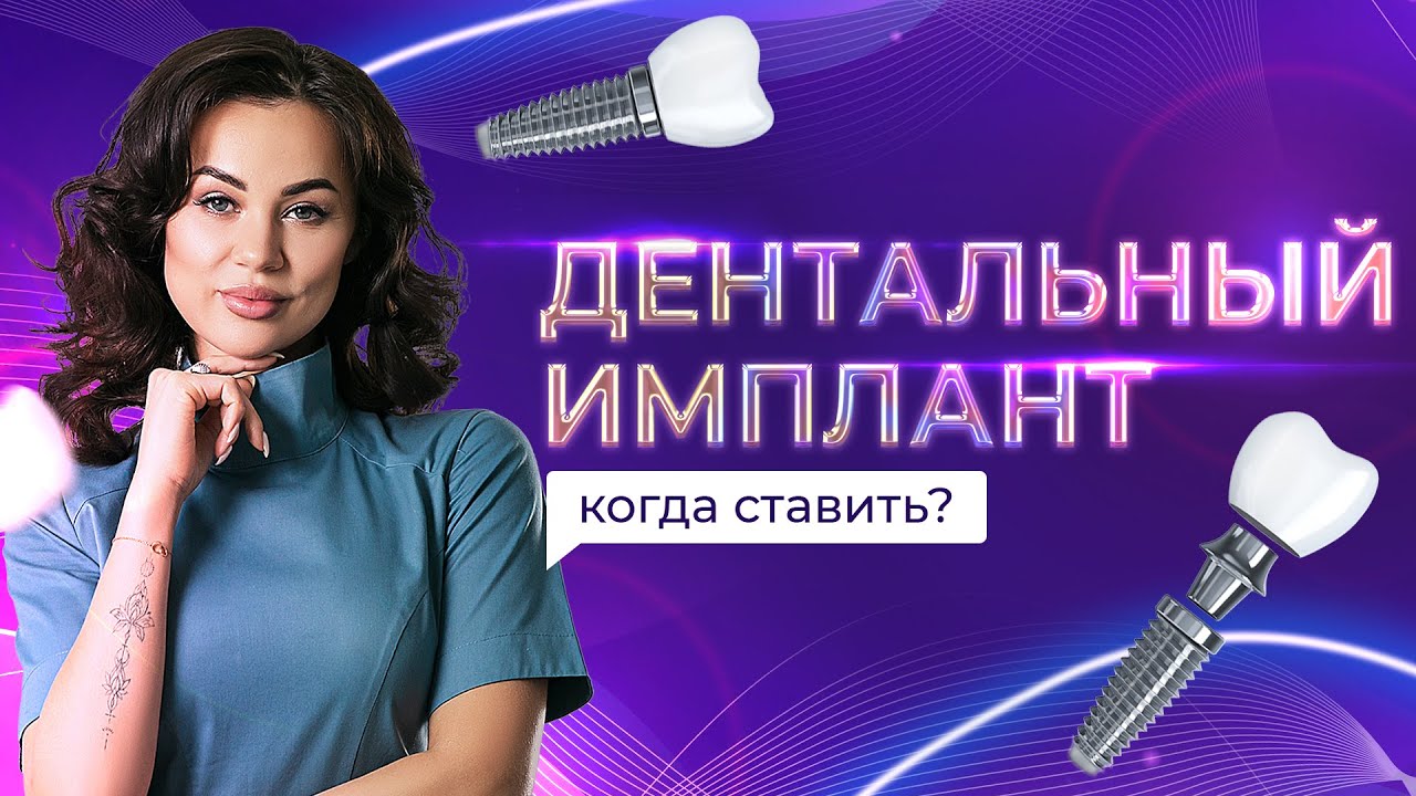 Когда установить дентальный имплант? - YouTube
