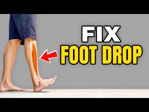 3 Exercises to Correct Foot Drop