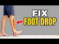 3 Exercises to Correct Foot Drop