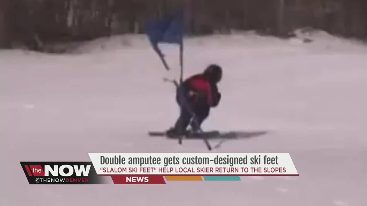 Double amputee gets custom-designed ski feet - YouTube