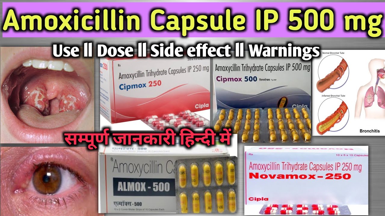 Amoxicillin 500 mg Capsule l Amoxicillin capsule IP 500 mg l Uses, Dose, Sideeffects, Moa ,Warnings