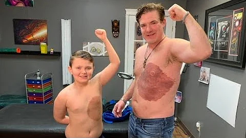 When Derek Prue Sr. noticed his son wasn't comfortable with a large birthmark, he decided to do some
