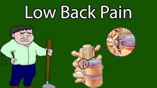 Low back Pain - Types, Causes, Symptoms and Treatment screenshot 3