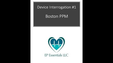 CRM: PPM 1 BSX