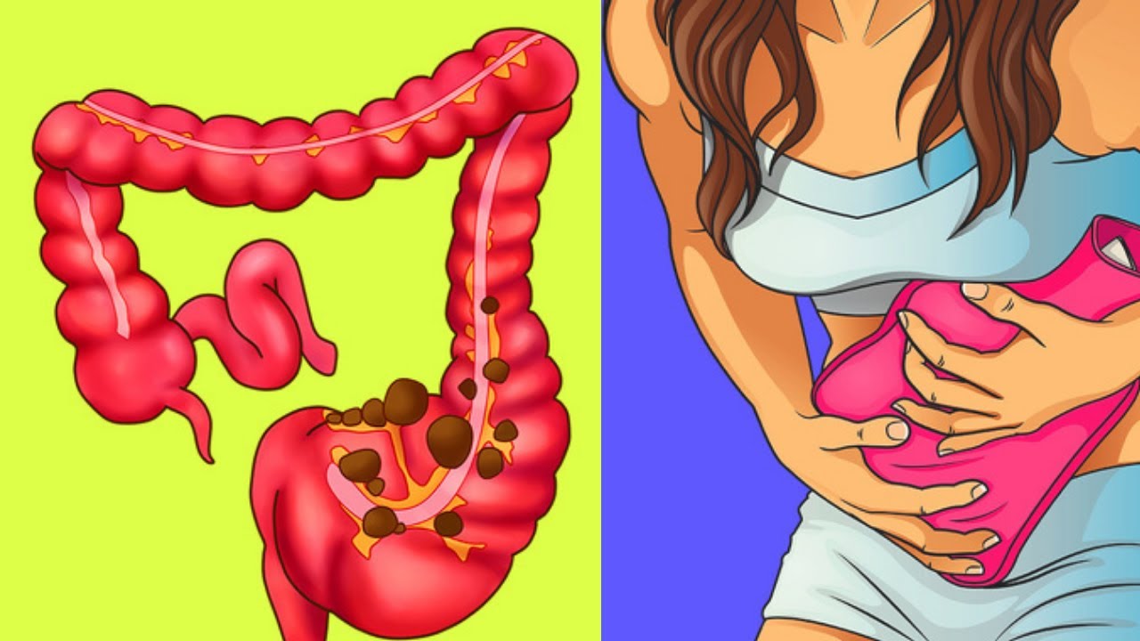 TCK COLON DETOX CLEANSE | Overnight colon cleanse & cleansing naturally! | Colon Cleanse Supplement