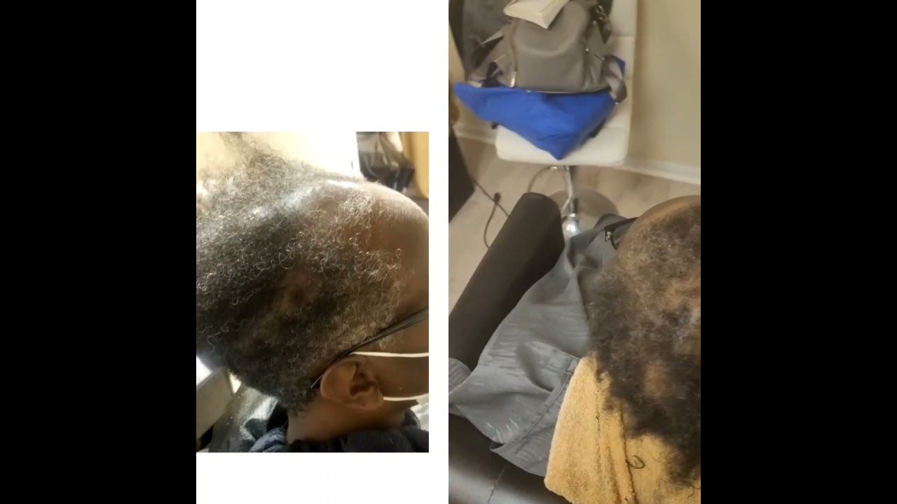 Learn How To Regrow Hair with Alopecia from a Certified Trichologist