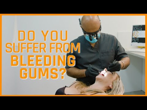 How to stop bleeding gums - In the Chair with Dr. Bobby Chhoker Ep 25