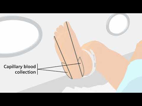 Proper Sample Handling - Capillary