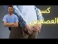الم العصعص كسر عظمة العصعص كسر العصعص علاج العصعص دكتور احمد حسن جمعه 