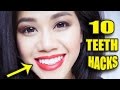 10 Teeth Whitening Hacks TESTED at Home 💋 DIY Life Hacks Everyone Should Know