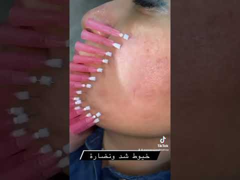 خيوط شد ونضارة لاصحاب البشرة المتهدلة الباهتة الفاقدة للحيوية نحدد بيهة كل ملامح الوجه 07717649600