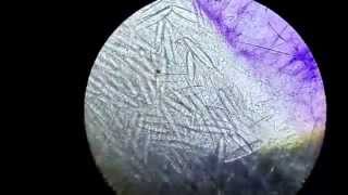 Nematocysts Firing Harrrd