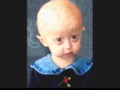 Progeria Movie WMV