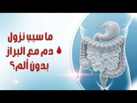 ما سبب نزول دم مع البراز بدون الم