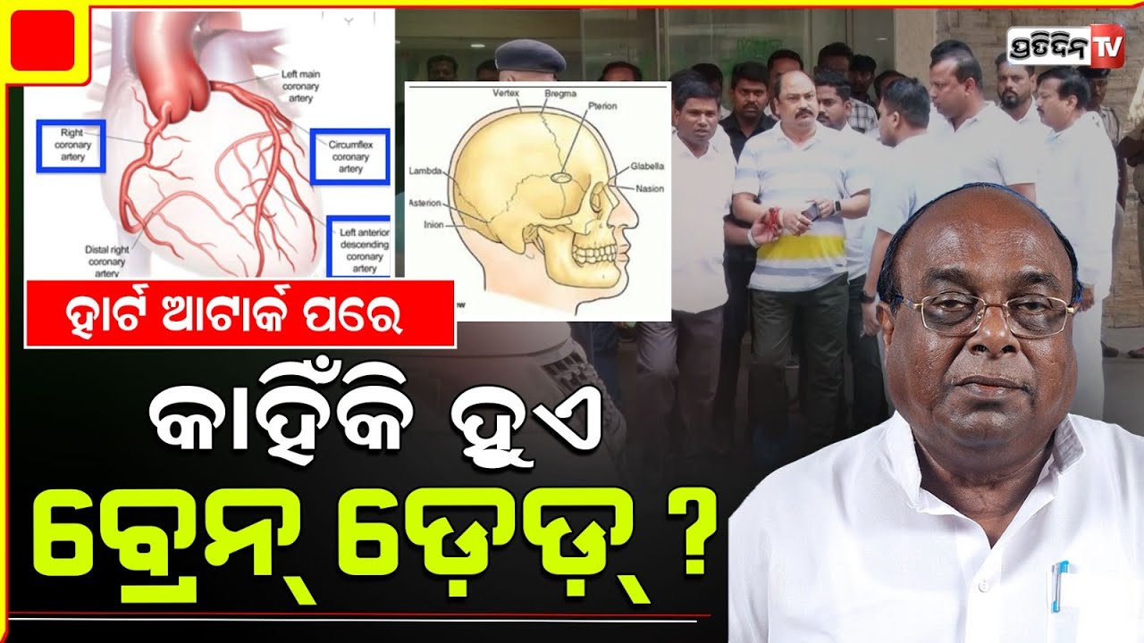 କଣ ଅଟେ ଦାମ ରାଉତଙ୍କ ବ୍ରେନଡେଡ୍ ଅବସ୍ଥା ? What is Brain dead condition of BJD leader Damodar Rout.