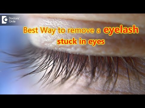 Vídeo: Eyelash In Eye: Como Remover Com Segurança E Outras Dicas