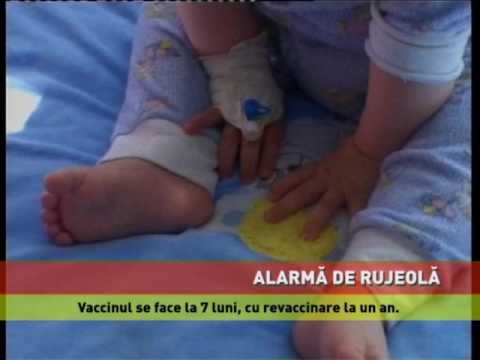 Epidemie De Rujeolă în Rândul Copiilor Marcată De Trei Decese Youtube
