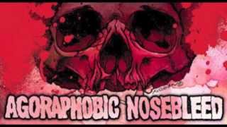 Watch Agoraphobic Nosebleed The Big Fuck You video