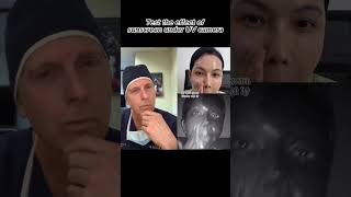 Test the effect of sunscreen under UV camera Wealth