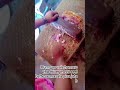 dehate mixar