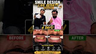 🔥 Smile Design Transformation | Kolkata Patient’s 4-Day Smile Makeover 😱✨