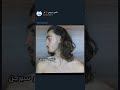 سرعه نمو الشعر دكتور سيرجن