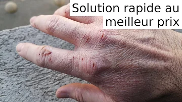 Pourquoi j'ai les mains sèches ?