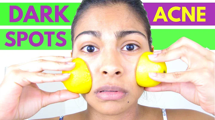 Can I rub a lemon on my skin? (2023)