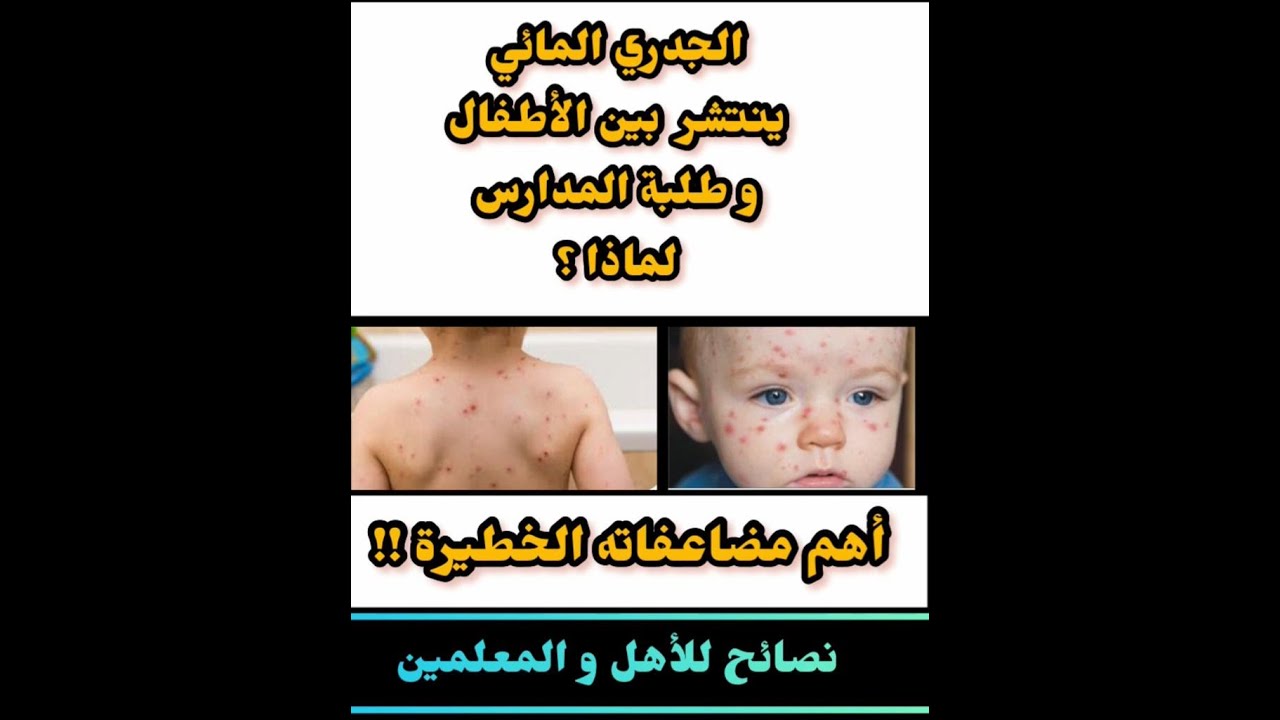 أين يظهر الانزلاق المائي السلاسة المائية في الغالب بشدة