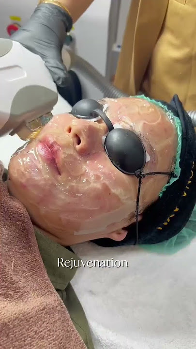 Atasi permasalahan kulit jerawat kamu di Pesona Ayu Beauty Clinic🫵🏻🥰✨