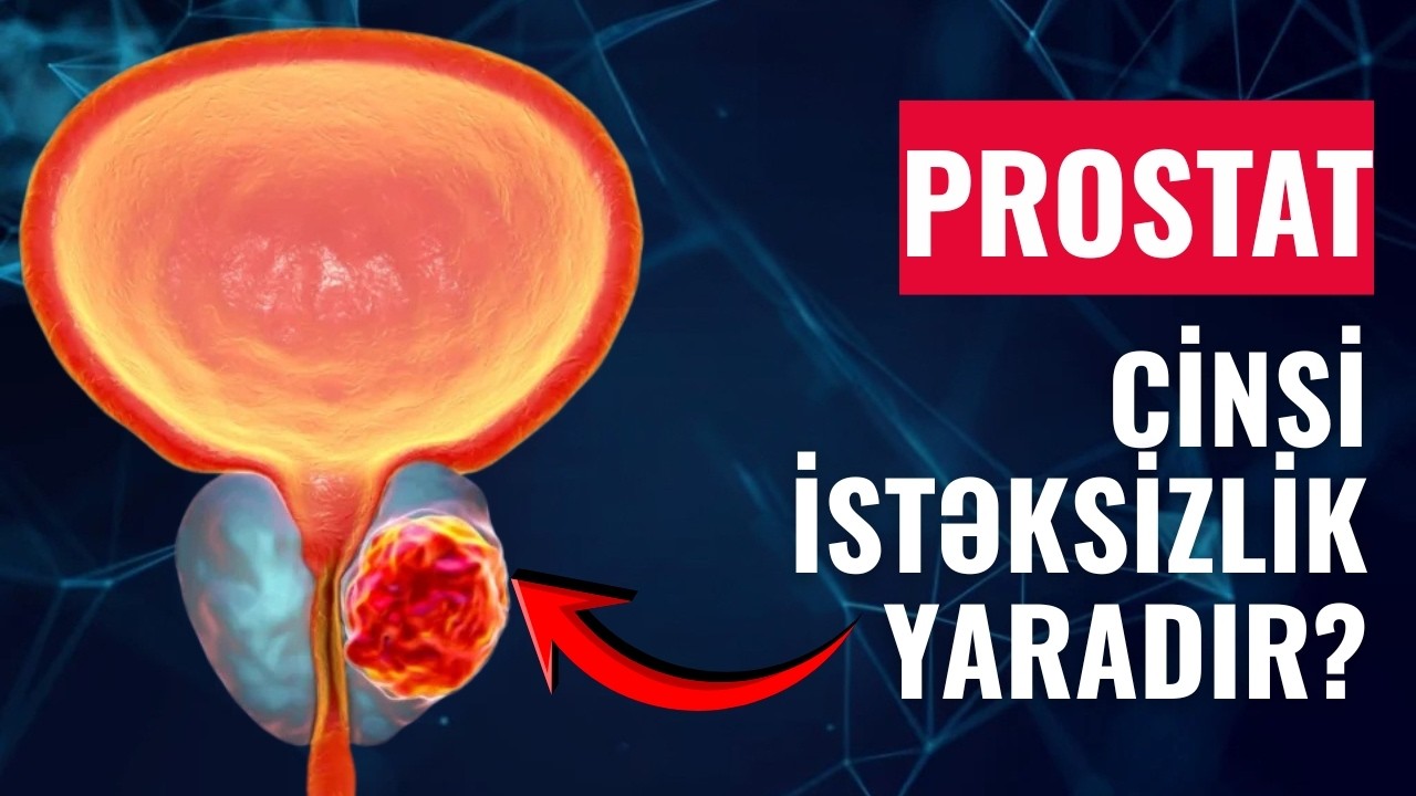 Prostat və cinsi həyat: Nəyi bilməlisiniz? ANDROLOQDAN AÇIQLAMA