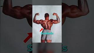 Working Out With Muscle Imbalances?