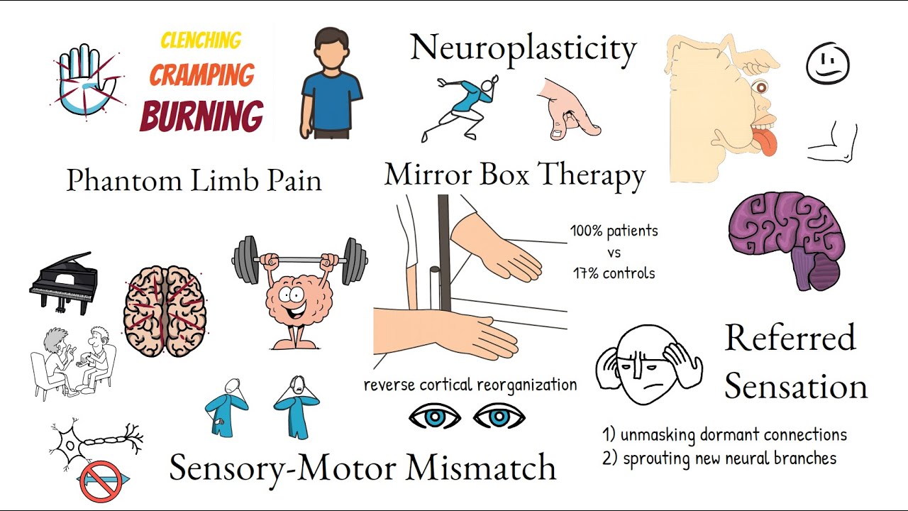 Neuroplasticity's Dark Side: Phantom Limb Pain