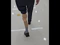 종아리 의지 하퇴 의족 실리콘타입 보행