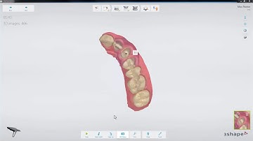3Shape 트리오스 – HD 포토 – 3Shape TRIOS – HD Photo