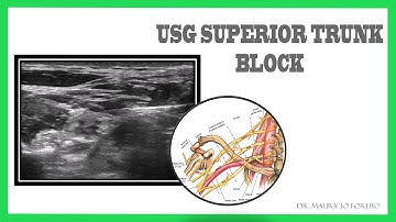 USG Superior Trunk Block