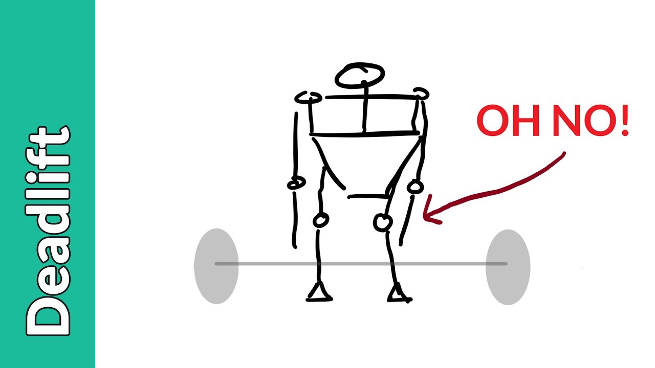 Knee Cave During Deadlifts